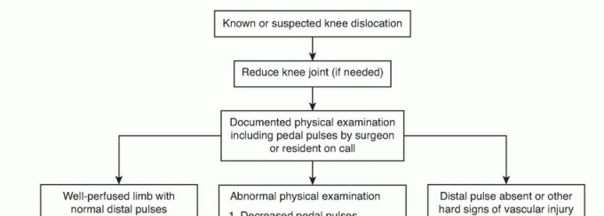 Illustration of multiligament knee injuries - Dr. Mohammed Hutaif