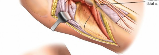 Figure 23: Patient performing functional rehabilitation exercises such as mini-squats.
