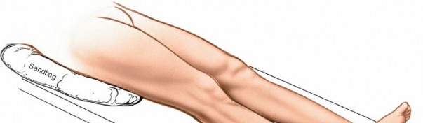 Detailed: Lateral Malleolus Lateral Approach for Surgeons
