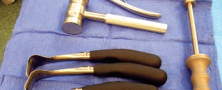 Illustration 12 for Cemented TKA Figure: Your Visual Guide to Surgical Success