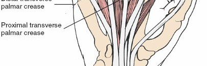 Illustration 141 for Essential Surgical Approaches: Uncover Every Aspect of the Wrist