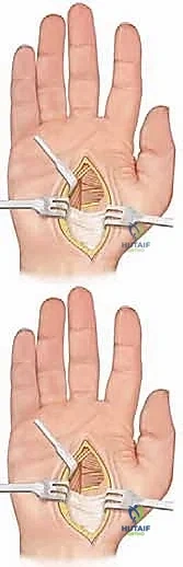 Clinical Image