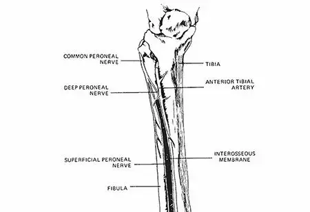 صورة توضيحية لـ كسور عظم الساق والشظية: دليل شامل للمرضى مع الأستاذ الدكتور محمد هطيف
