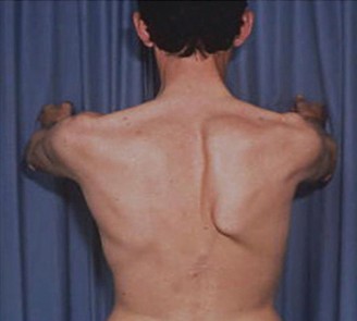 Illustration 7 for Solve Shoulder & Elbow Cases: When a Patient Presents to Clinic