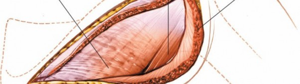 Illustration 171 for Essential Guide: Mastering Every Approach to the Shoulder