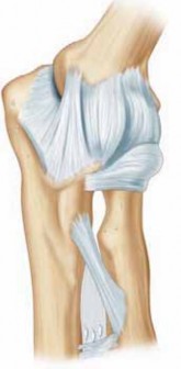 Arthroscopic Elbow Treatment: Restoring Motion From Degrees to Degrees