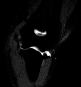 Illustration 92 for Right Shoulder Pain? Avoid This Common X-ray Mistake.