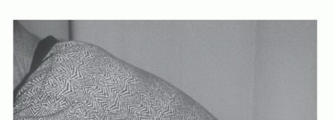 صورة طبية: تجنب الجراحة الكبرى: علاج أورام العظام بالنيتروجين السائل بتقنية الصب المباشر