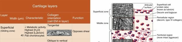 Illustration of articular cartilage damage - Dr. Mohammed Hutaif