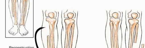 صورة توضيحية للعلاج الطبيعي