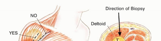 وصف طبي دقيق للمريض