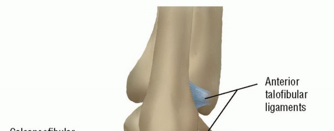 Learn the Hamstring Graft: How to Pass the Tendon for Ankle Stability