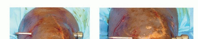 Knee Loss of Motion: Understand Causes & Restore Mobility