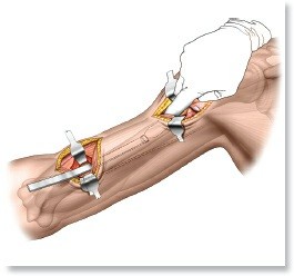 Essential Guide: Mastering Every Approach to the Shoulder