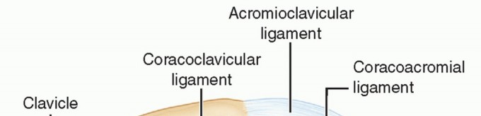 Nonarticular Scapular Fractures: ORIF Decision-Making & Technique