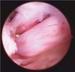 Illustration 24 for First Metatarsal Surgery: Expert Solutions for Foot & Ankle Pain