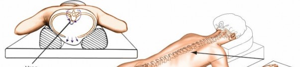 Mastering the Spine Posterior Approach: Surgical Essentials
