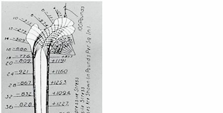 Subtrochanteric Fractures: Anatomy, Forces, and Healing Challenges