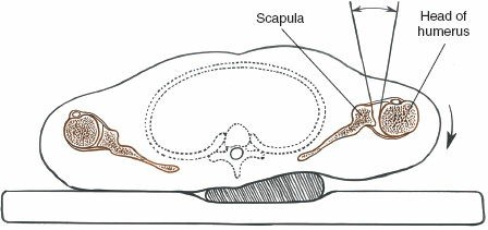 Illustration 5 for Essential Guide: Mastering Every Approach to the Shoulder