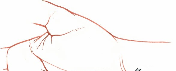 Illustration 87 for Essential Surgical Approaches: Uncover Every Aspect of the Wrist