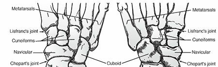 Mastering First MTP Joint & Forefoot Fractures: A Comprehensive Guide