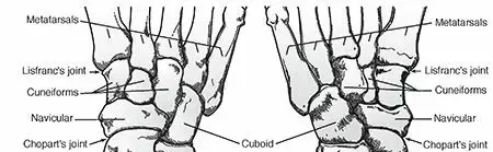 كسور منتصف القدم ومقدمتها: دليل شامل للتعافي مع الأستاذ الدكتور محمد هطيف