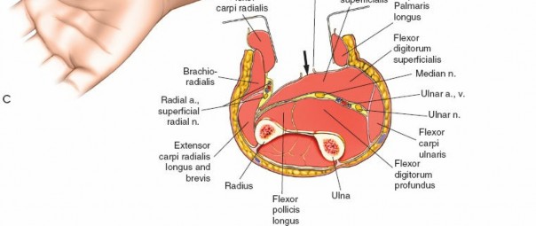Illustration 92 for Mastering Approaches to the Upper Third of the Radius