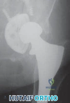 Clinical Image