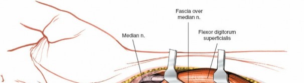 Illustration 80 for Essential Surgical Approaches: Uncover Every Aspect of the Wrist