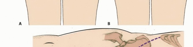 وصف طبي دقيق للمريض