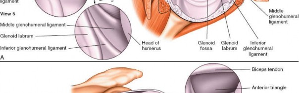 Illustration 236 for Essential Guide: Mastering Every Approach to the Shoulder