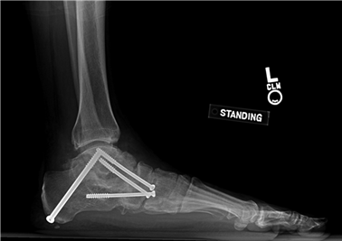 Illustration 112 for First Metatarsal Surgery: Expert Solutions for Foot & Ankle Pain