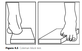 Illustration 2 for Cavus Foot Examination Question: Ace Your Oral Exam Prep