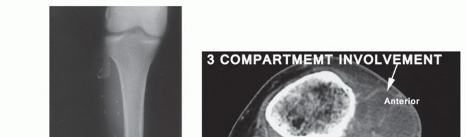 وصف طبي دقيق للمريض