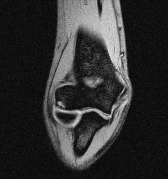 Illustration 66 for Solve Shoulder & Elbow Cases: When a Patient Presents to Clinic