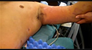 Orthopedic Surgery Mock Exam - Set 20F57B