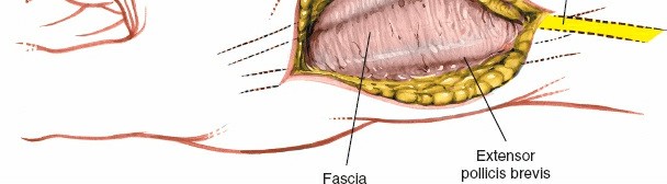 Illustration 193 for Essential Surgical Approaches: Uncover Every Aspect of the Wrist