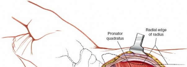 Illustration 57 for Essential Surgical Approaches: Uncover Every Aspect of the Wrist