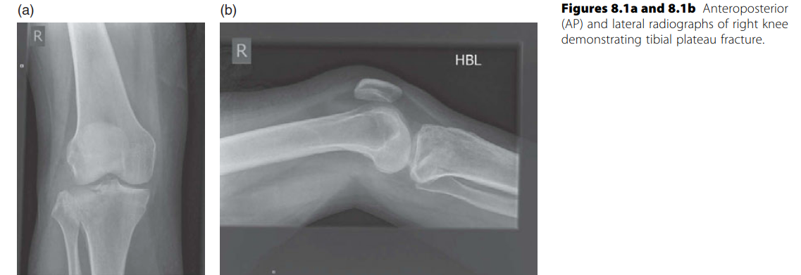 Lower Limb Trauma SOE: What Examiners Expect You to Comment On