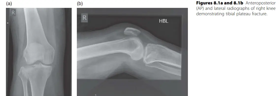 صورة توضيحية لـ إصابات الطرف السفلي: دليلك الشامل للتشخيص والعلاج والتعافي مع الأستاذ الدكتور محمد هطيف في صنعاء