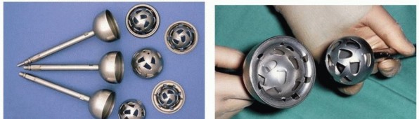 Illustration 12 for Hip Arthrodesis: The Definitive Hip Solution for Active Young Adults