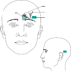 Illustration 15 for Exploring Every Approach to the Cervical: A Surgeon's Guide