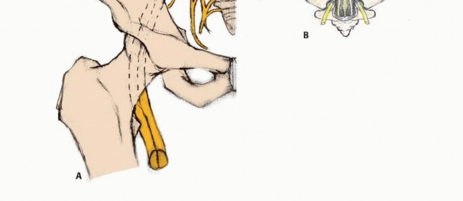 وصف طبي دقيق للمريض