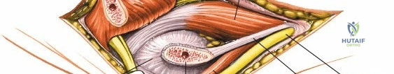 Diagnosis and Measurement of Forearm and Hand Compartment Syndrome