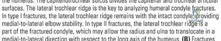 Illustration of distal humerus fractures - Dr. Mohammed Hutaif