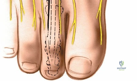 Clinical Image