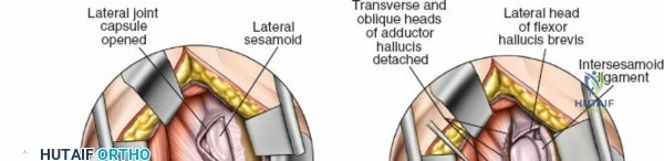 Clinical Image