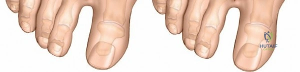 Clinical Image