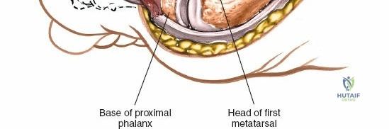 Clinical Image