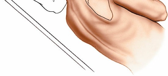 Illustration 158 for Essential Guide: Mastering Every Approach to the Shoulder